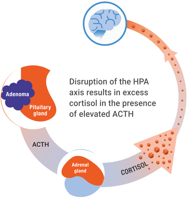  Adrenocorticotropic hormone (ACTH)-­dependent hypercortisolism.