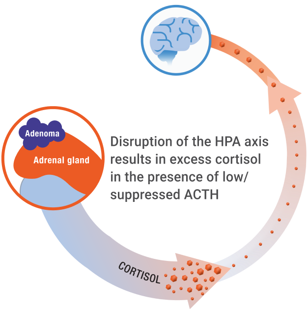 ACTH-­independent hypercortisolism.